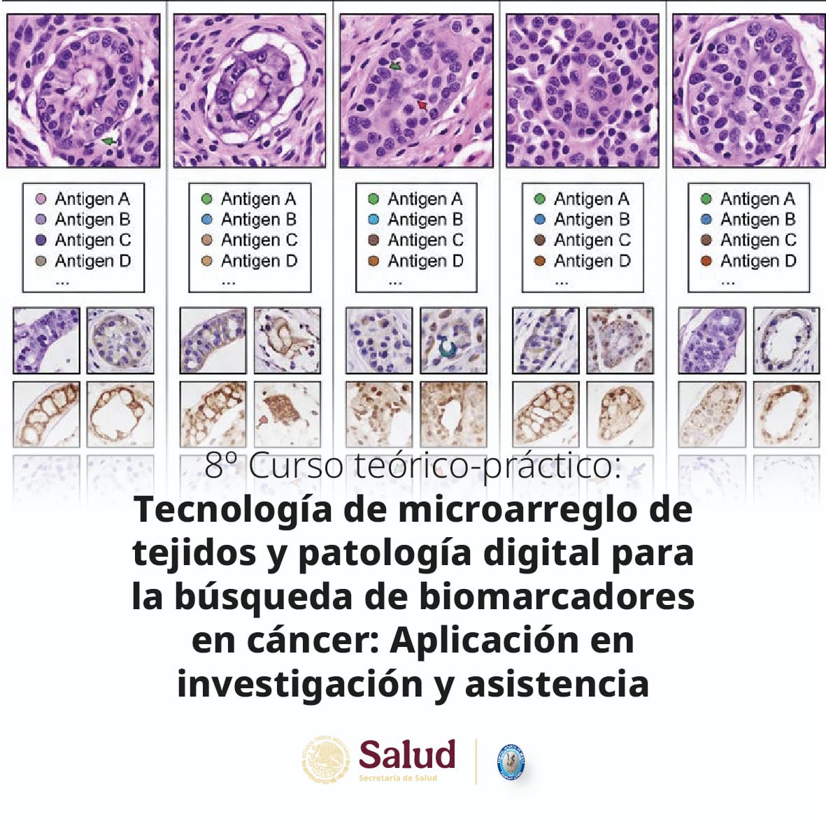 8o Curso teórico-práctico: Tecnología de microarreglo de tejidos y patología digital para la búsqueda de biomarcadores en cáncer: Aplicación en investigación y asistencia